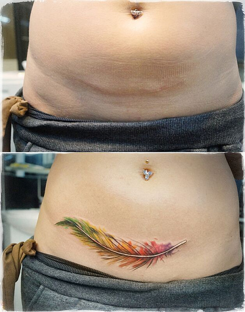 Тату перекрытие шрама на животе