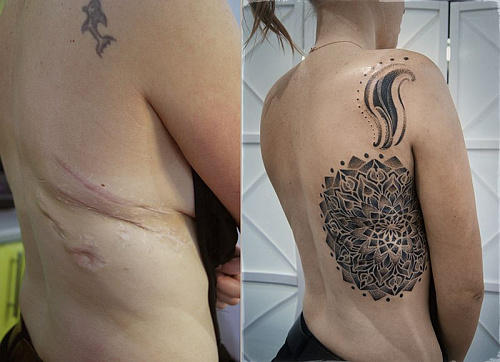 Тату мандала на шраме