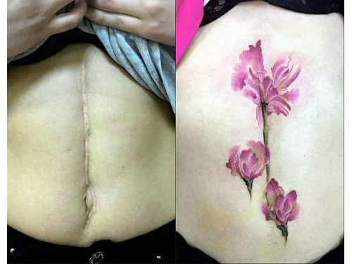 Тату кавер ап цветок на шраме