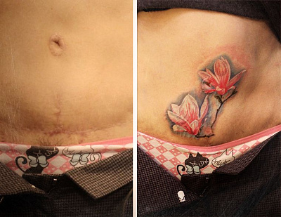 Татуировка цветок перекрытие шрама